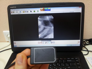 рентгеновский снимок зуба