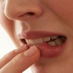 Воспаление слизистой оболочки полости рта и десен