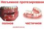 несъемное протезирование зубов