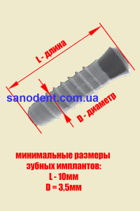 зубной имплантат