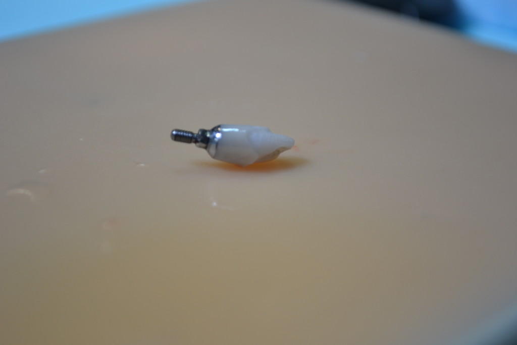 абатмент из циркония