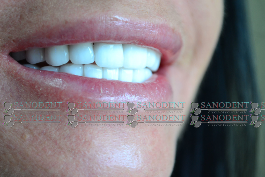 яркая улыбка