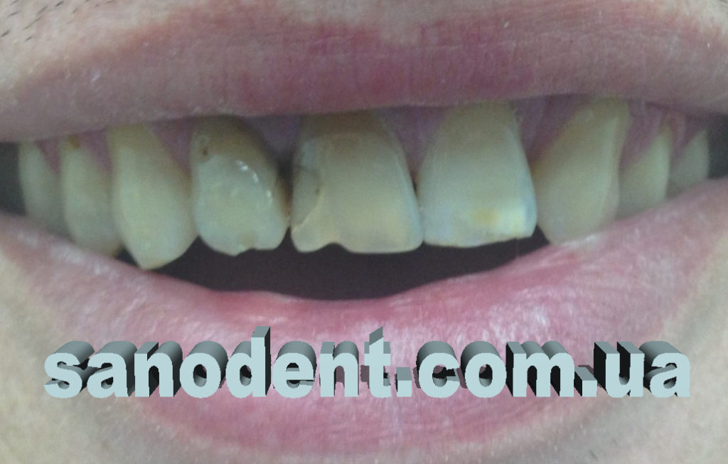 до реставрации