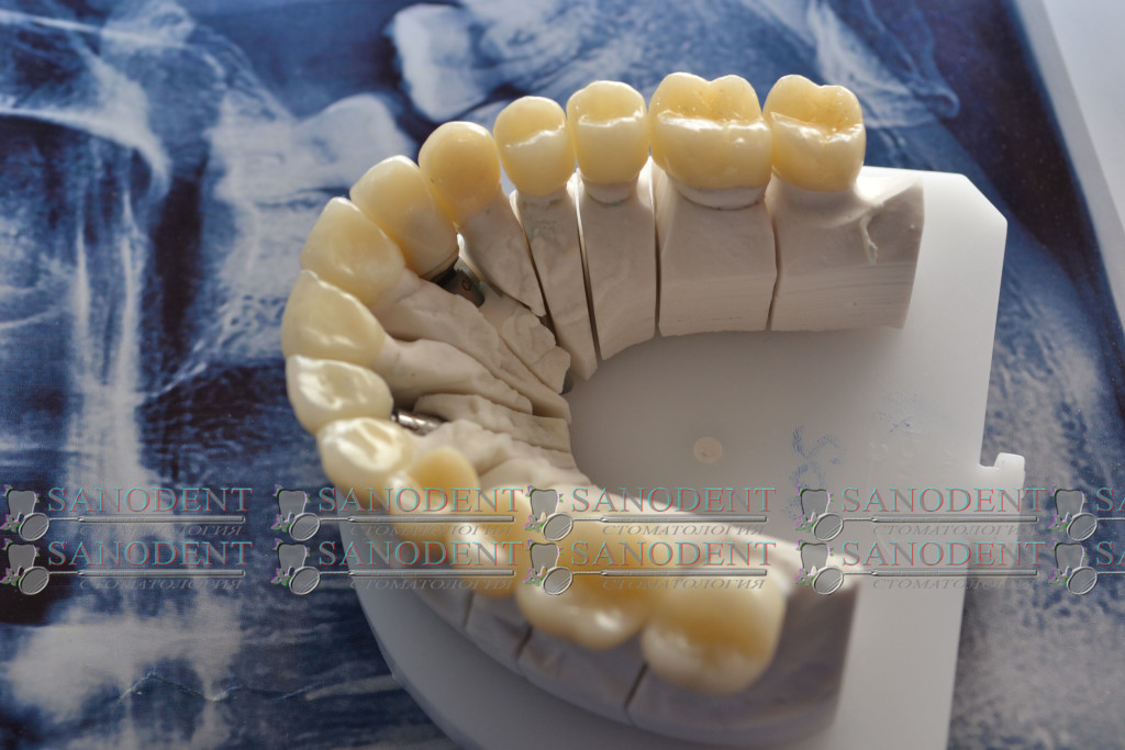 прессованная керамика