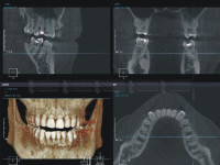 КТ диагностика ротовой полости