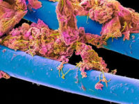 вид зубной щетки под микроскопом