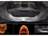 ортопантомограмма