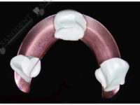 ложка для снятия слепка челюсти