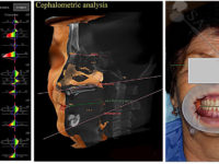 программа диагностики при съемном протезировании
