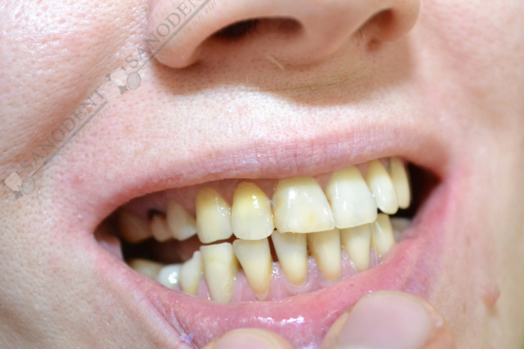 недостатки внешнего вида зубов