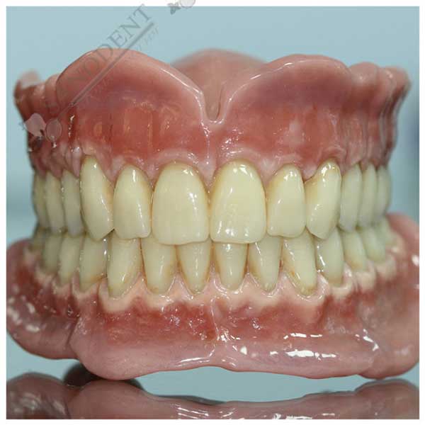 Стоматологические работы Санодент - съемное протезирование зубов