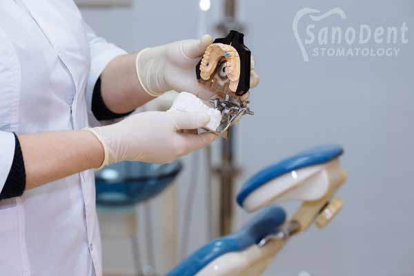 Диагностические слепки и модели для исправления прикуса