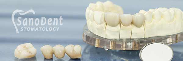Металлические зубные протезы