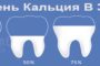 Что такое реминерализация зубов и глубокое фторирование эмали зубов и сколько это стоит в Харькове?
