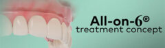 имплантация зубов все на шести all on 6