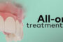 имплантация зубов все на шести all on 6